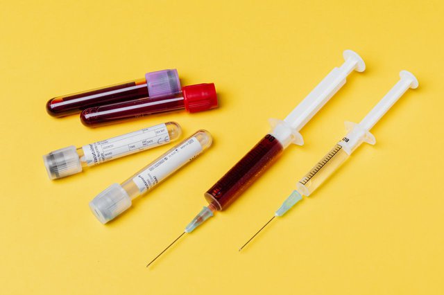 Пробирки и шприцы для взятия крови в AstraMED